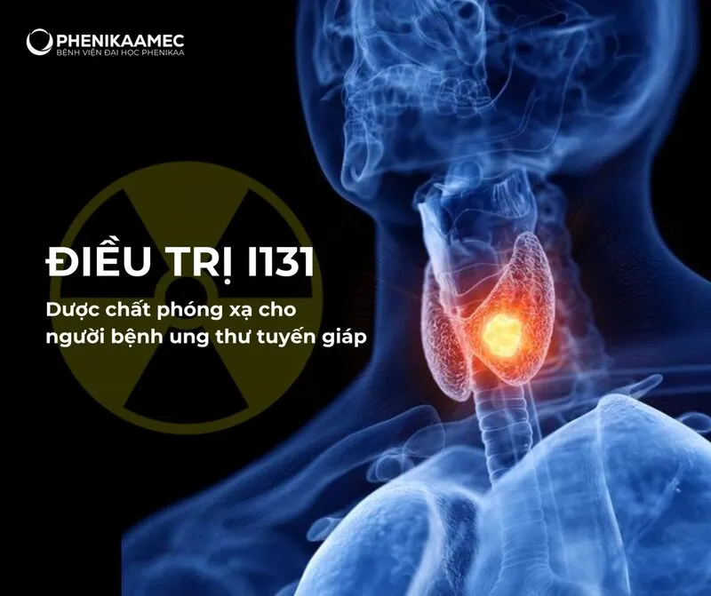 Điều trị I131 – Dược chất phóng xạ cho người bệnh ung thư tuyến giáp có mặt tại Dự án Bệnh viện Đại học Phenikaa